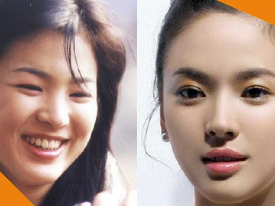 Tập gym giảm béo mặt 1